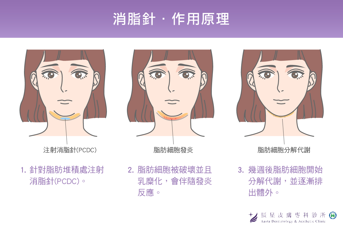 雙下巴醫美-消脂針作用原理