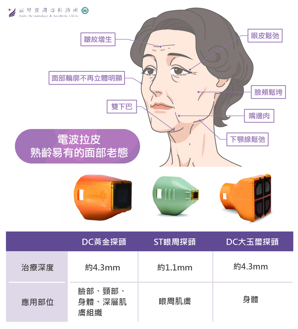 電波拉皮適用部位