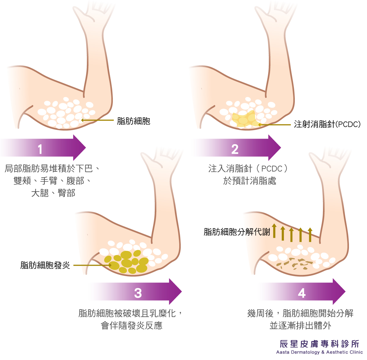 消脂針作用原理及過程