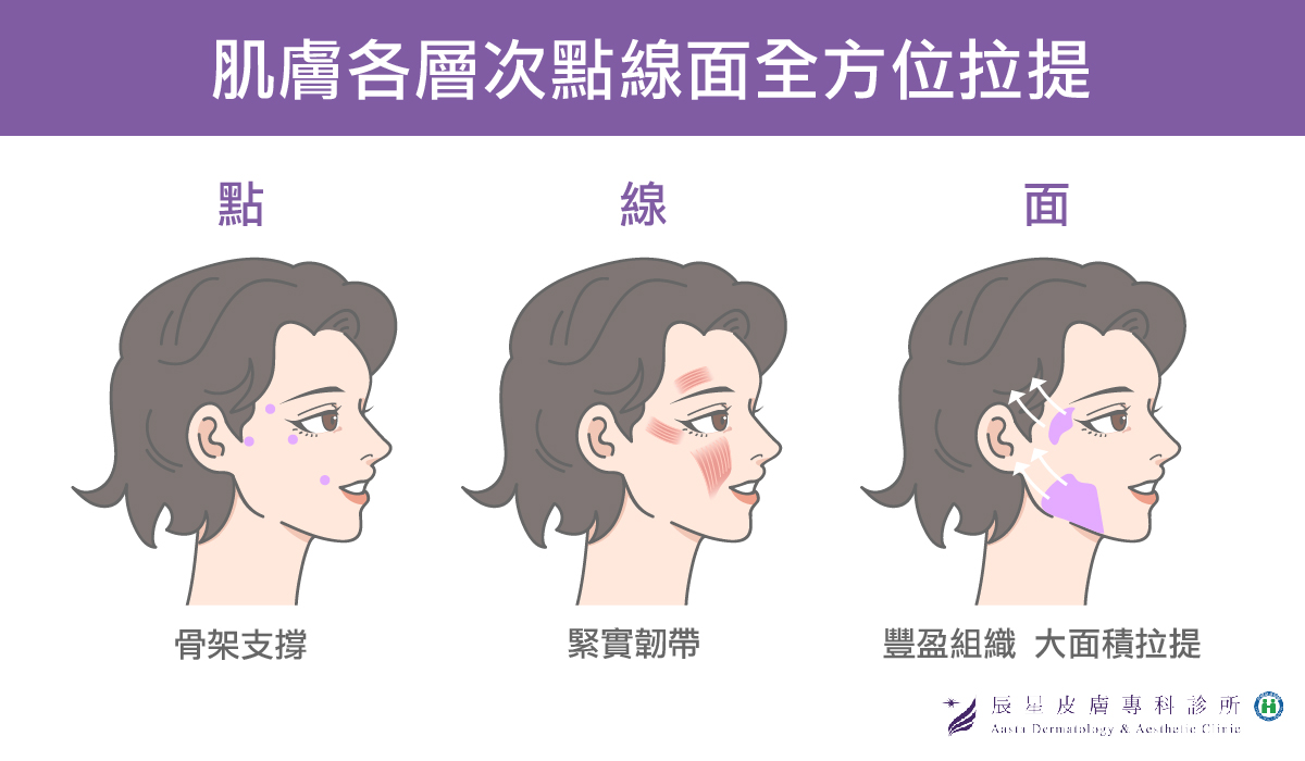 肌膚各層次點線面拉提