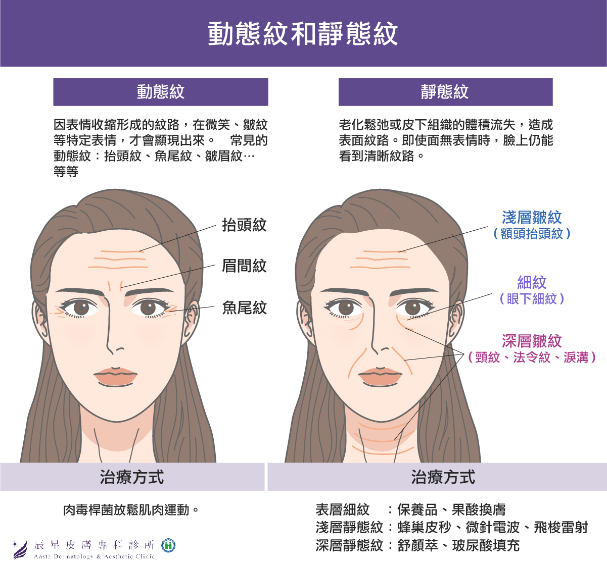 動態紋靜態紋的差異及治療方式