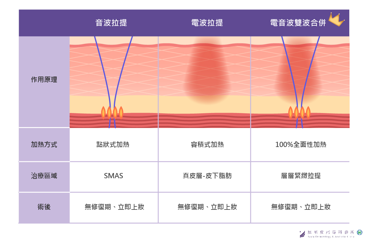 電音雙波效果比較圖表