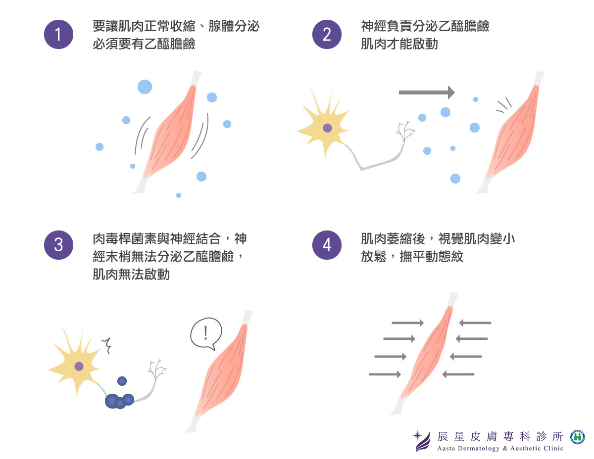 肉毒桿菌素作用原理