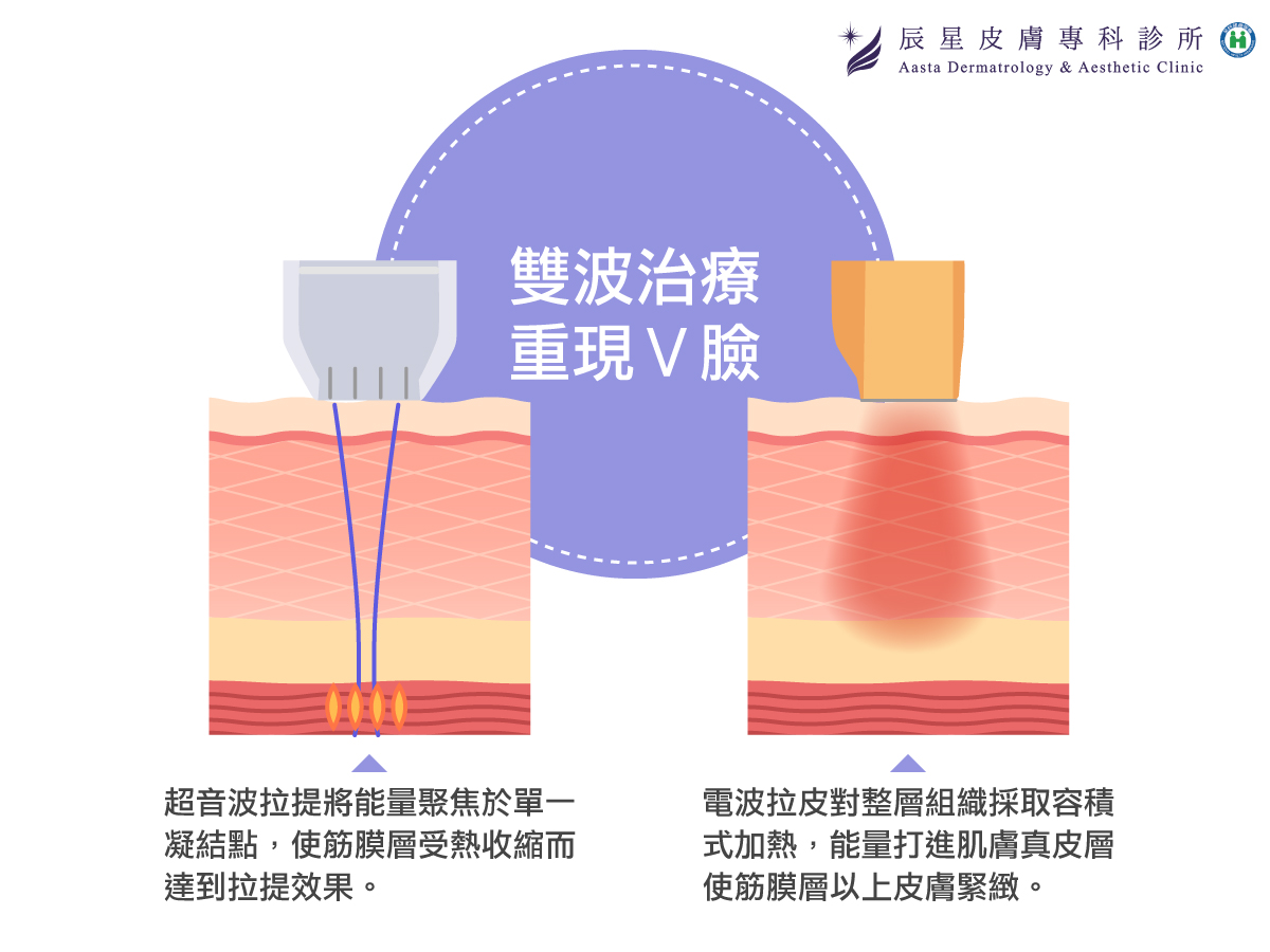 電音雙波重現緊緻Ｖ型臉