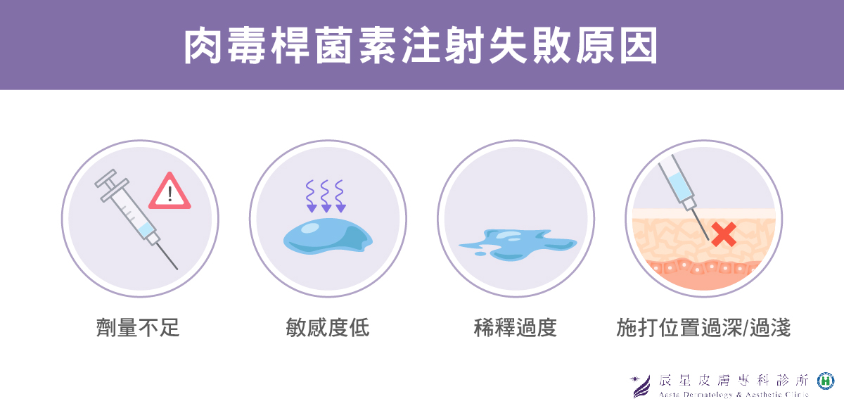 "肉毒桿菌"注射無效果或失敗的原因有4個