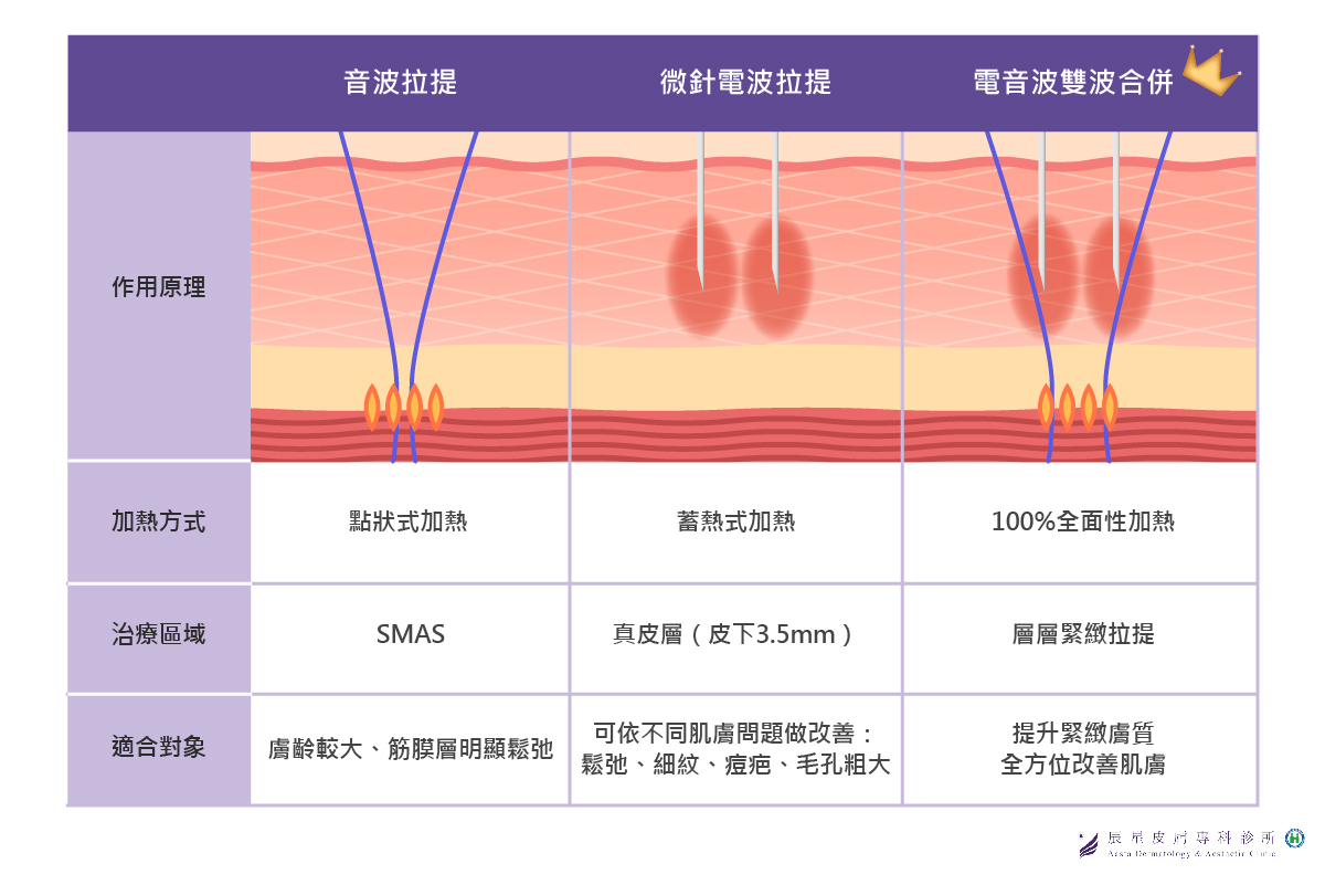 音波拉提與微針電波各有其特點，如果選用兩者搭配使用下，更可達到1+1>2的效果