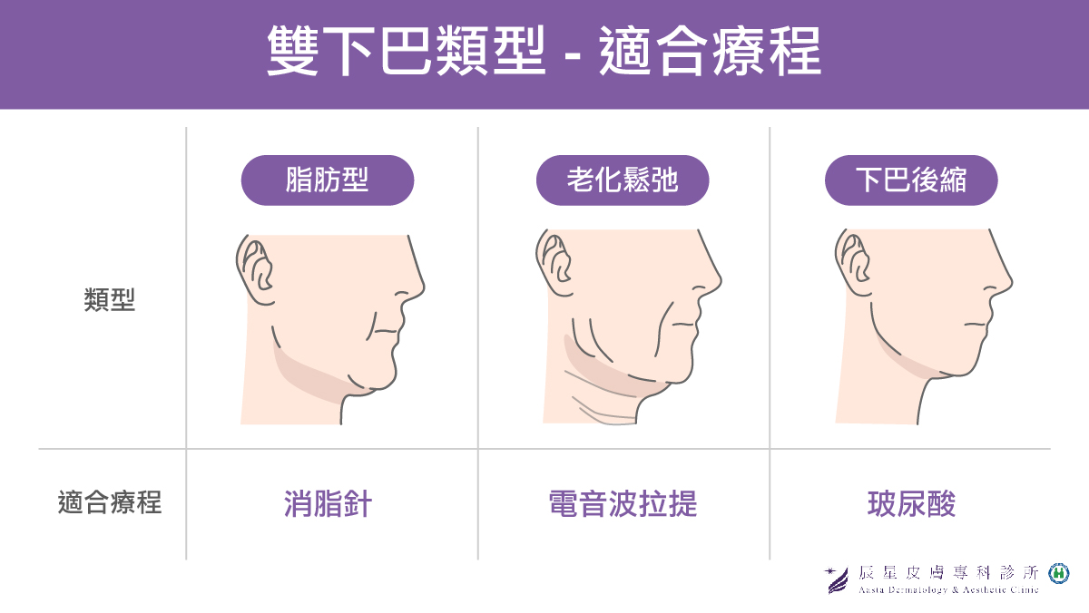 3種不同類型的下巴分別適合不同療程，並非所有問題都可以被玻尿酸改善