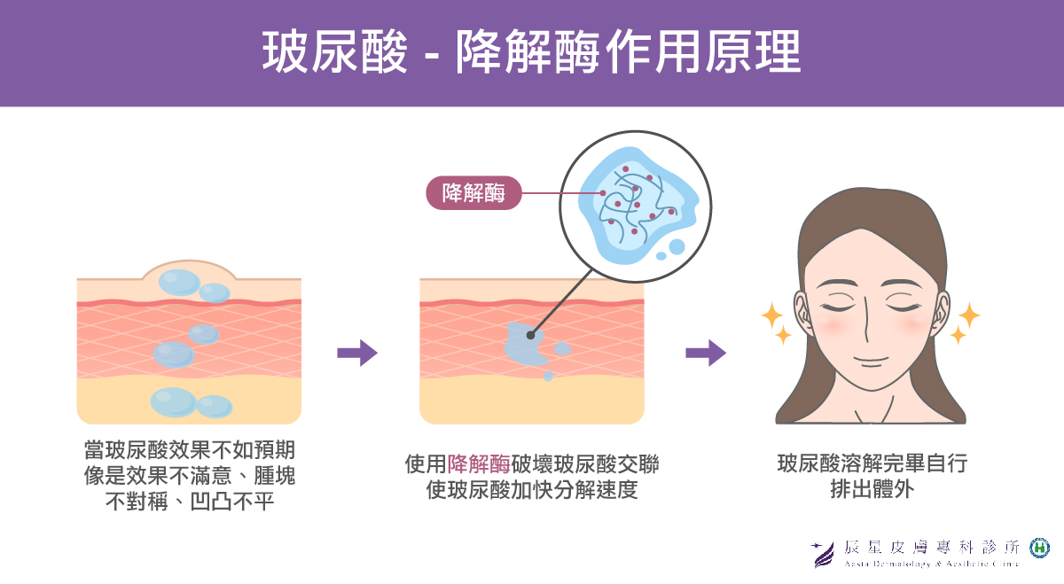 玻尿酸失敗施打降解酶分解