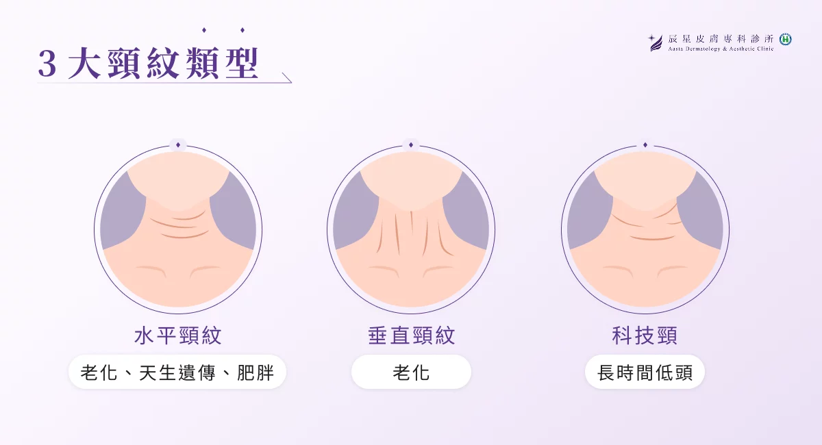 3 大頸紋類型