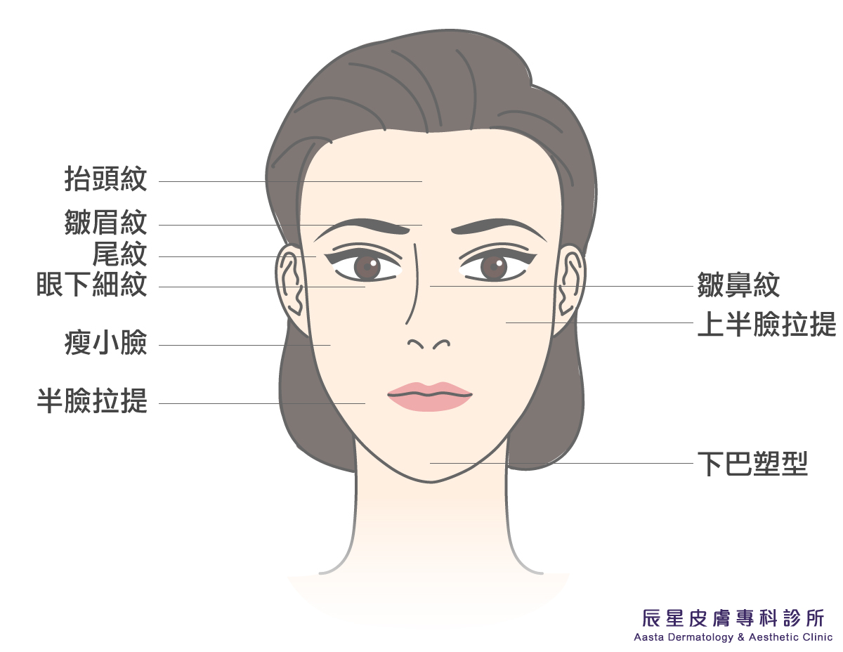 肉毒桿菌在臉上運用治療範圍非常廣泛