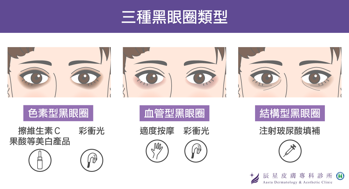 黑眼圈類型