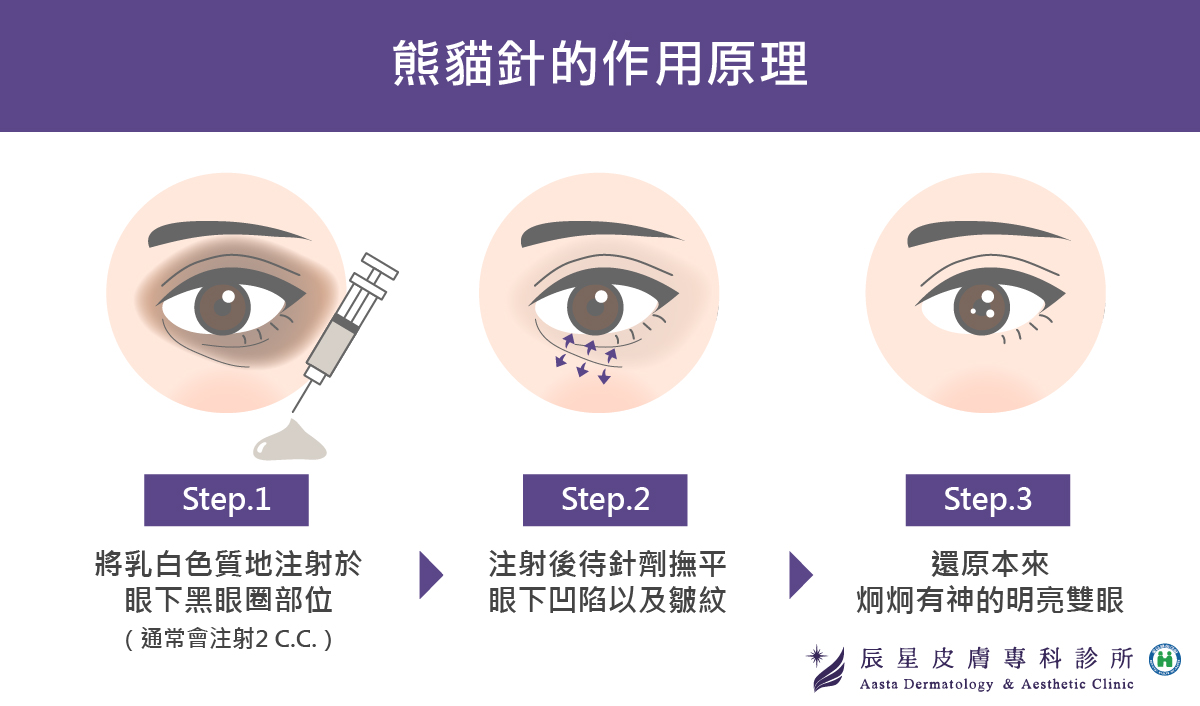 熊貓針的作用原理