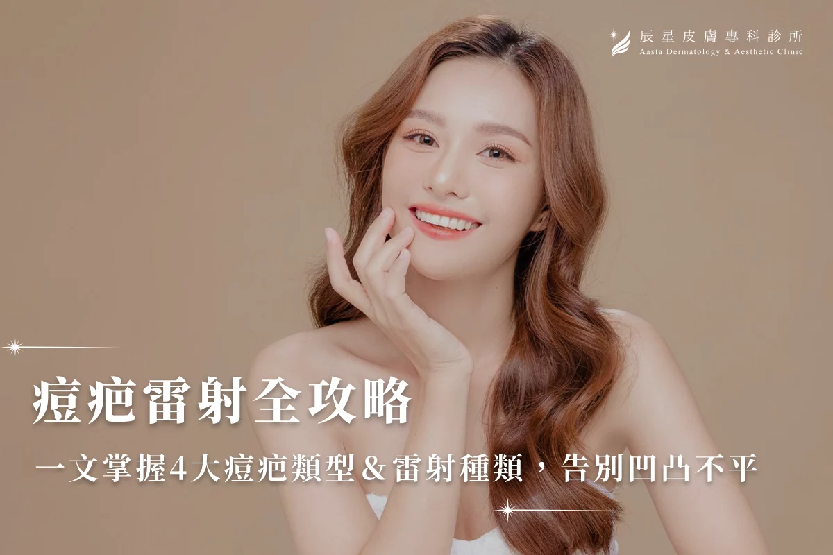 痘疤雷射全攻略｜一文掌握4大痘疤類型＆雷射種類，告別凹凸不平