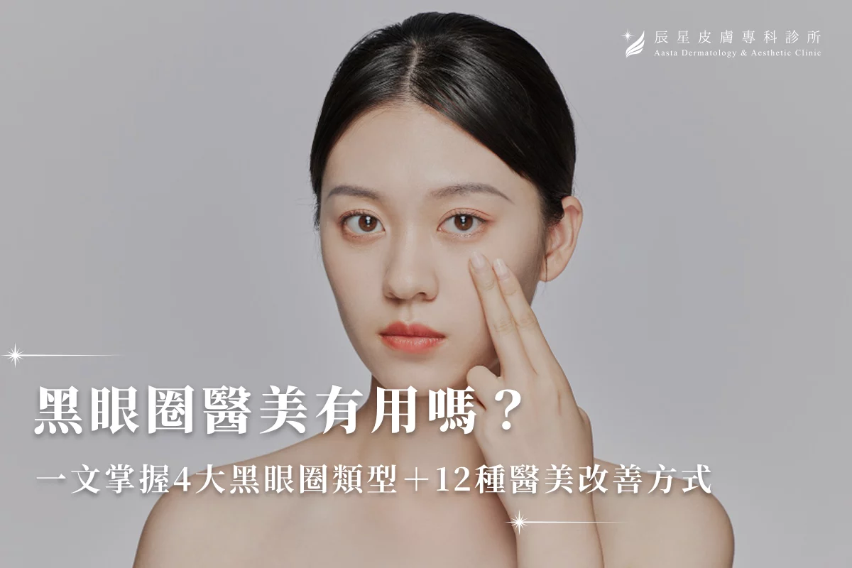 黑眼圈醫美有用嗎？一文掌握4大黑眼圈類型＋12種醫美改善方式