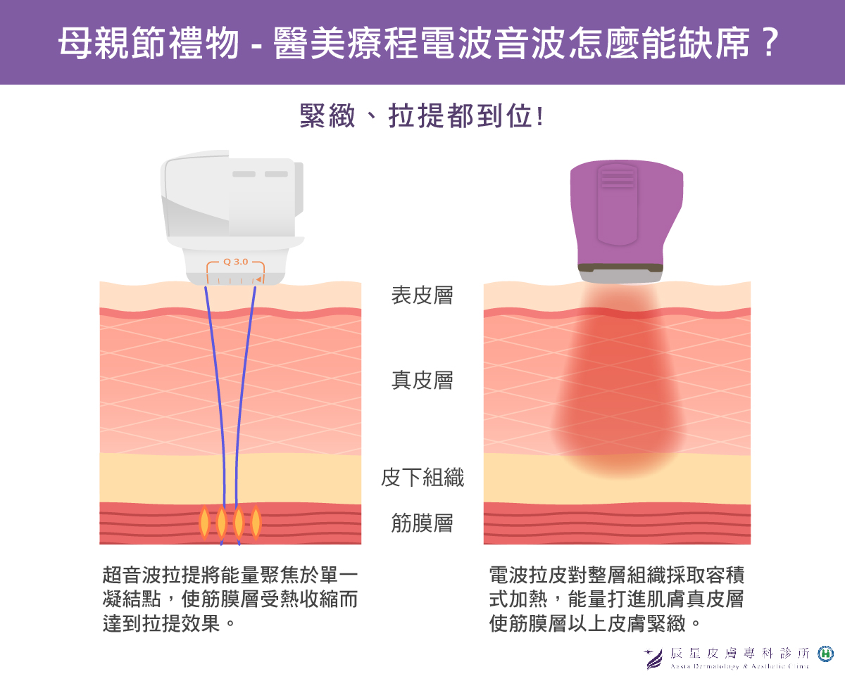 母親節禮物電音波