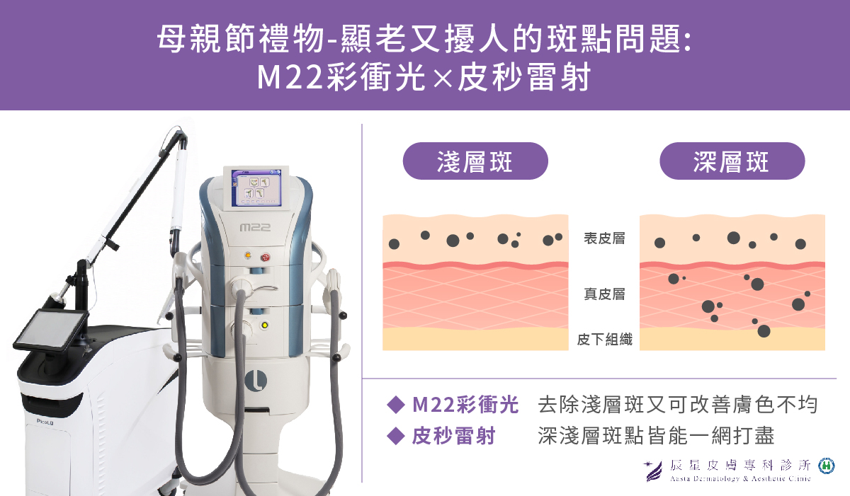 母親節抗老斑點問題