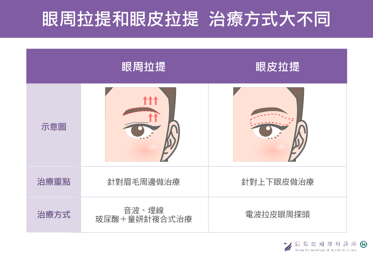 眼周拉提和眼皮拉提