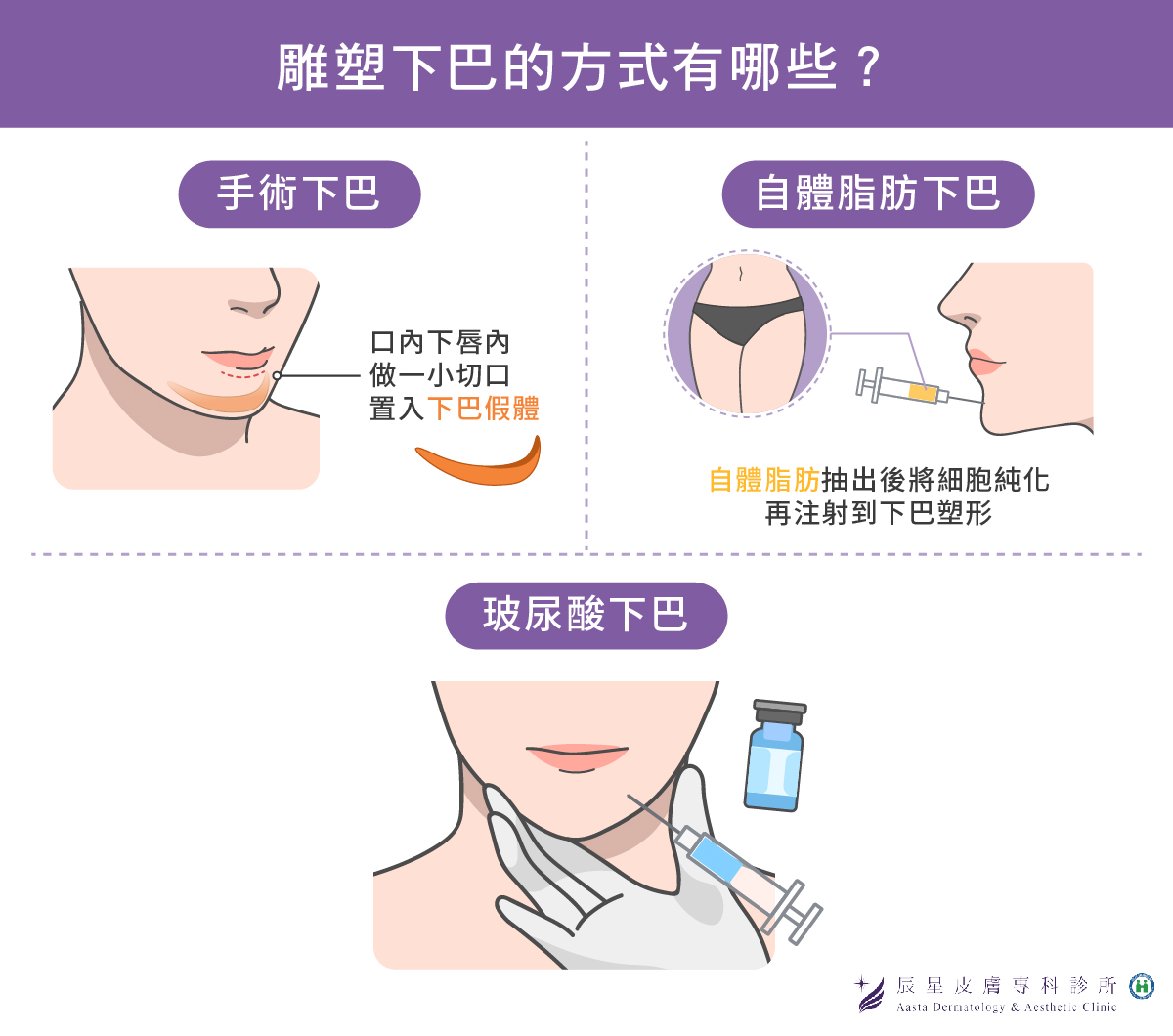 AS-0240606A-下巴輪廓線也是重點-02