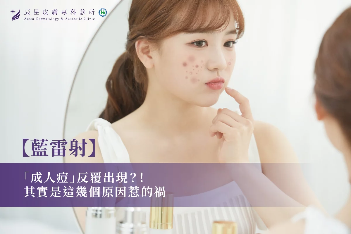 藍雷射，痘痘，藍雷射痘痘，痘痘治療，痘痘肌，成人痘