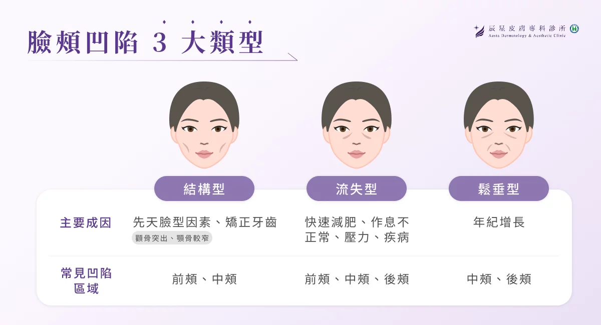 臉頰凹陷 3 大類型