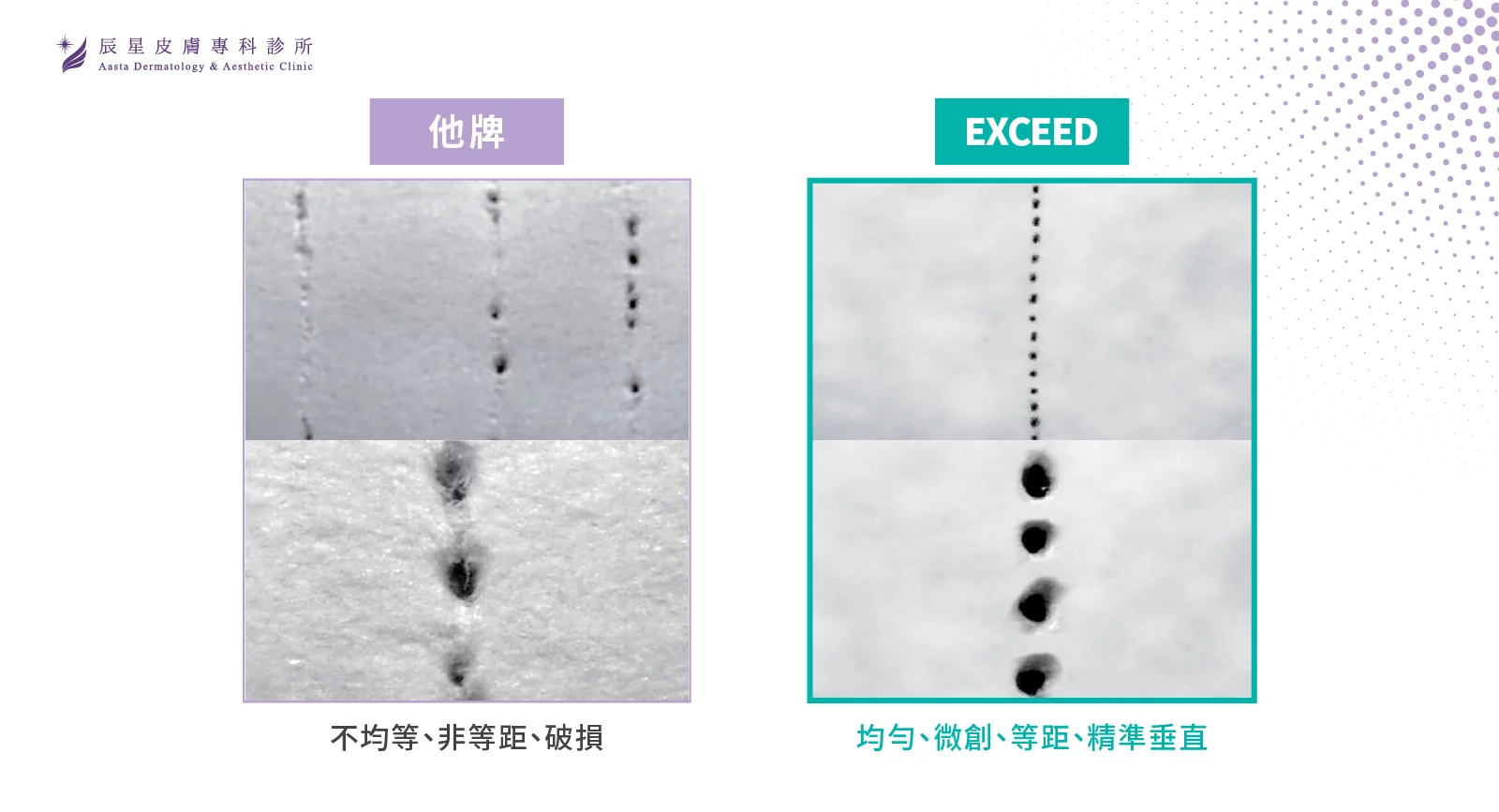 愛美微針-痘疤、細紋、毛孔粗大問題「針」的改善 - 辰星皮膚專科診所