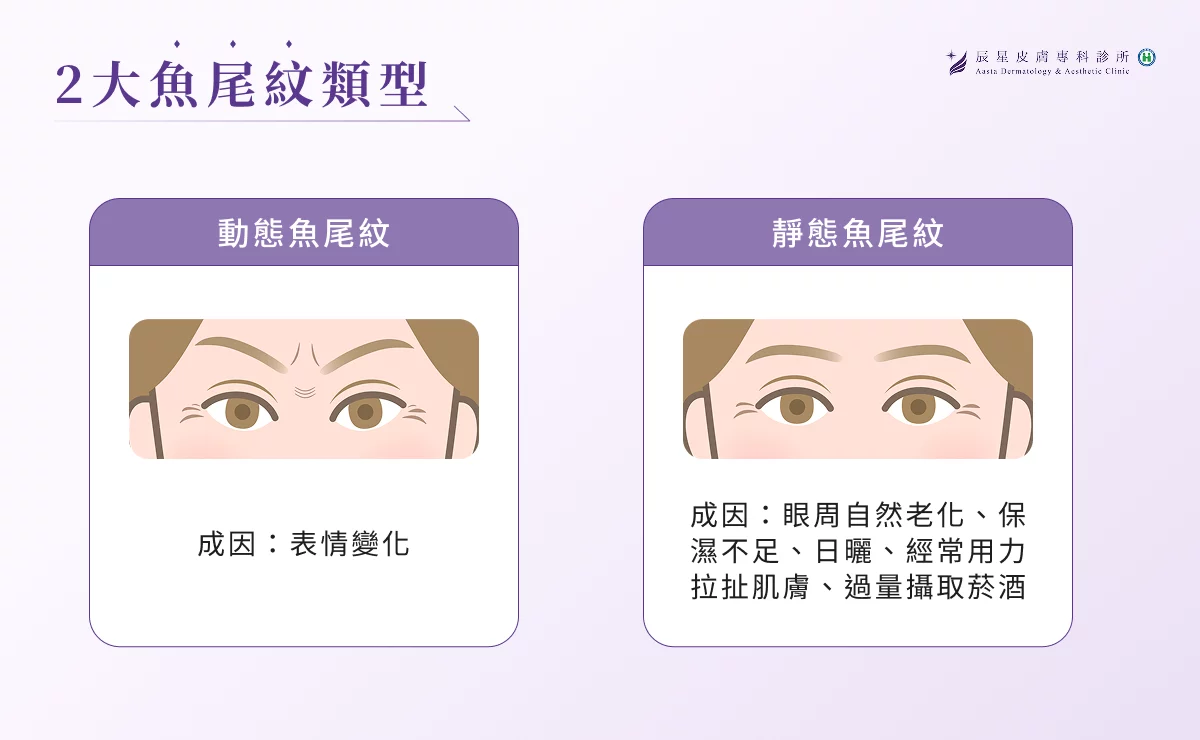 魚尾紋種類