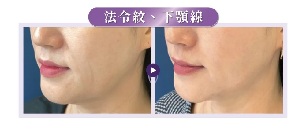 十倍電波效果案例2