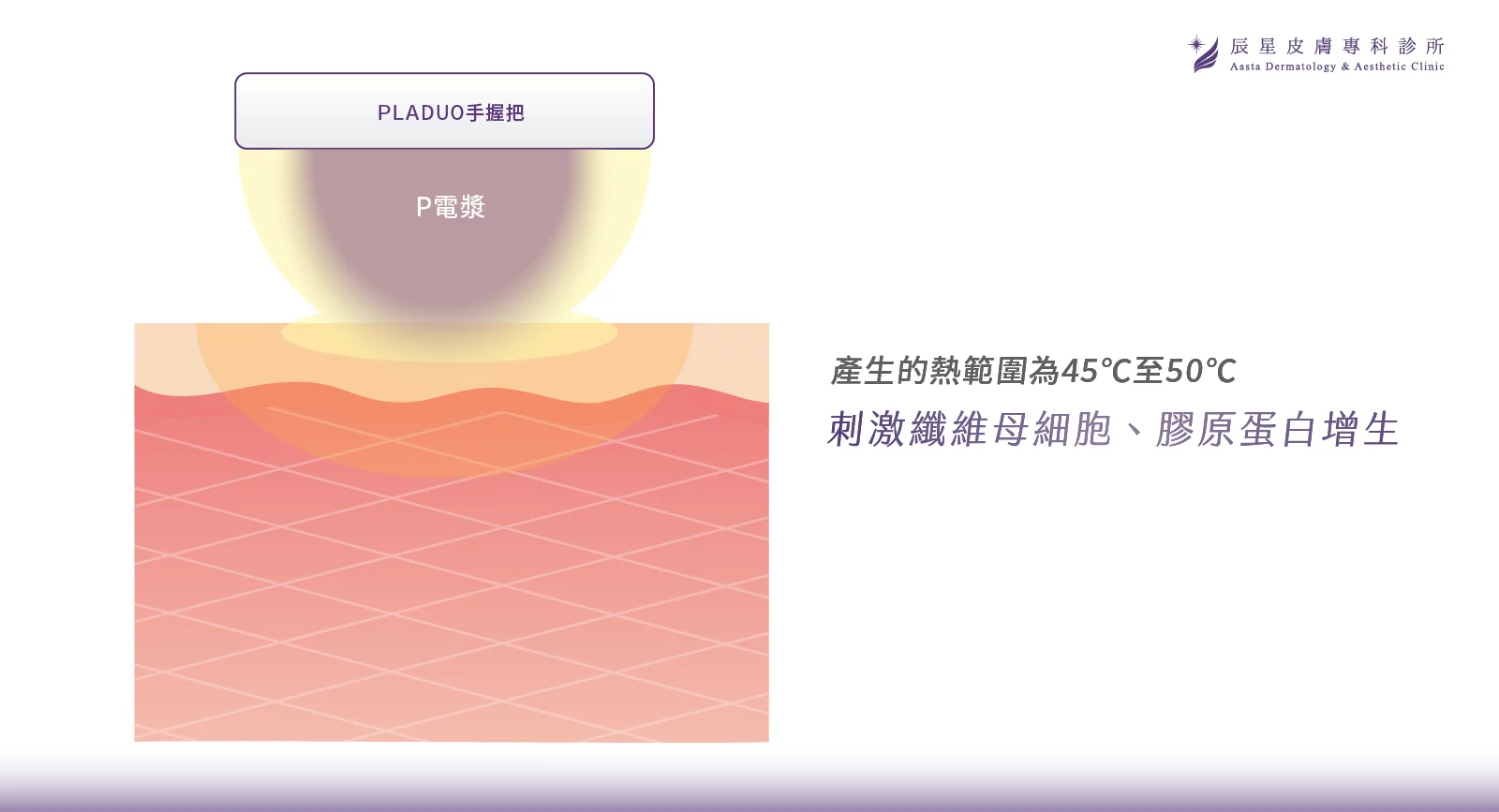 無針水光、P電漿 、超能電漿、電漿醫美、氦氣電漿 、pladuo、柏拉圖P電漿、毛孔粗大、皮脂腺、縮小毛孔、毛孔養膚