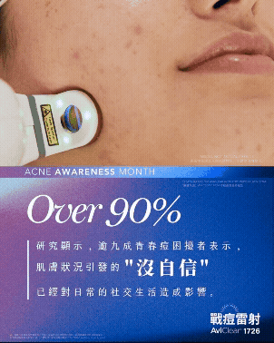 AviClear，AviClear戰鬥雷射，青春痘，成人痘，反覆長痘，皮脂腺分泌，痤瘡桿菌，痘痘，痘疤