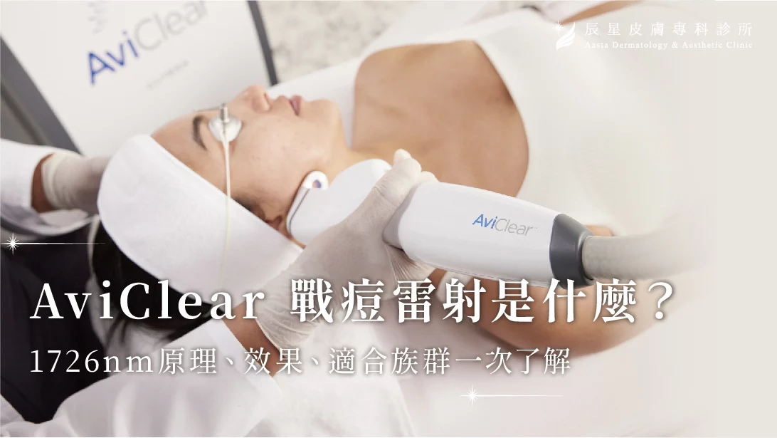 AviClear，AviClear戰鬥雷射，青春痘，成人痘，反覆長痘，皮脂腺分泌，痤瘡桿菌，痘痘，痘疤