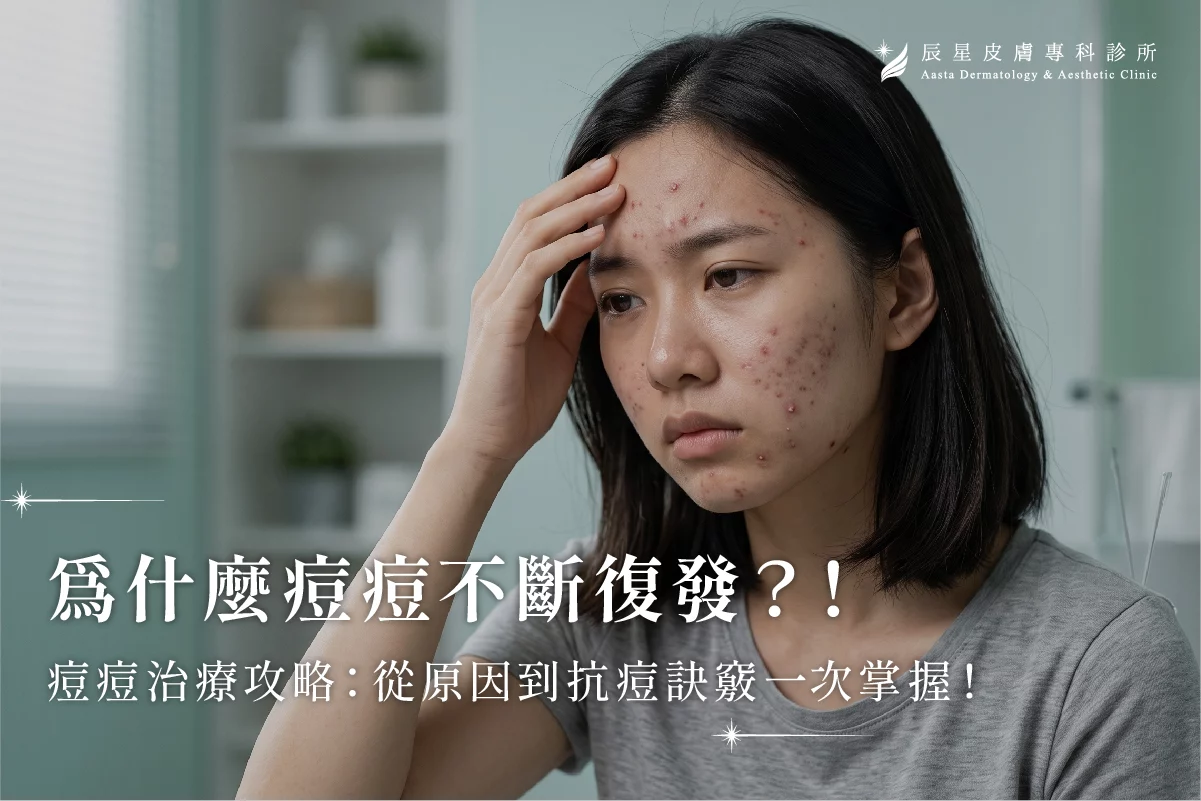 痘痘復發、反覆長痘、抗痘、痘痘、藍雷射、控油、A酸 、AviClear、戰痘雷射、痘痘雷射、痘疤雷射、痘痘肌